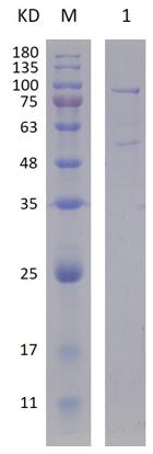 12% SDS-PAGE analysis profiles of purified KP1_4356-35-790 (CBB stained).